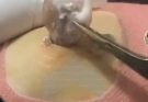 Blackheads & Whiteheads Satisfying Removal