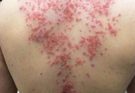 THESE ARE THE CONSEQUENCES OF SLEEPING