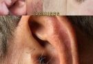 Did You Know? Why Ear Hairs Grow and What It Really Means for Your Body