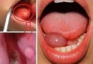 These Are The First Symptoms Of A…