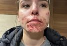His body was itchy, he thought it was an allergy