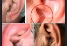 Did You Know That If Hair Grows on Your Ears, It’s Because Your Body Is…
